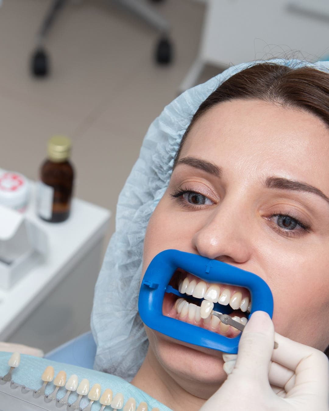 Cosmetic dentistry consultation with Dr. Aparna Balakrishnan at RamaCare Polyclinic