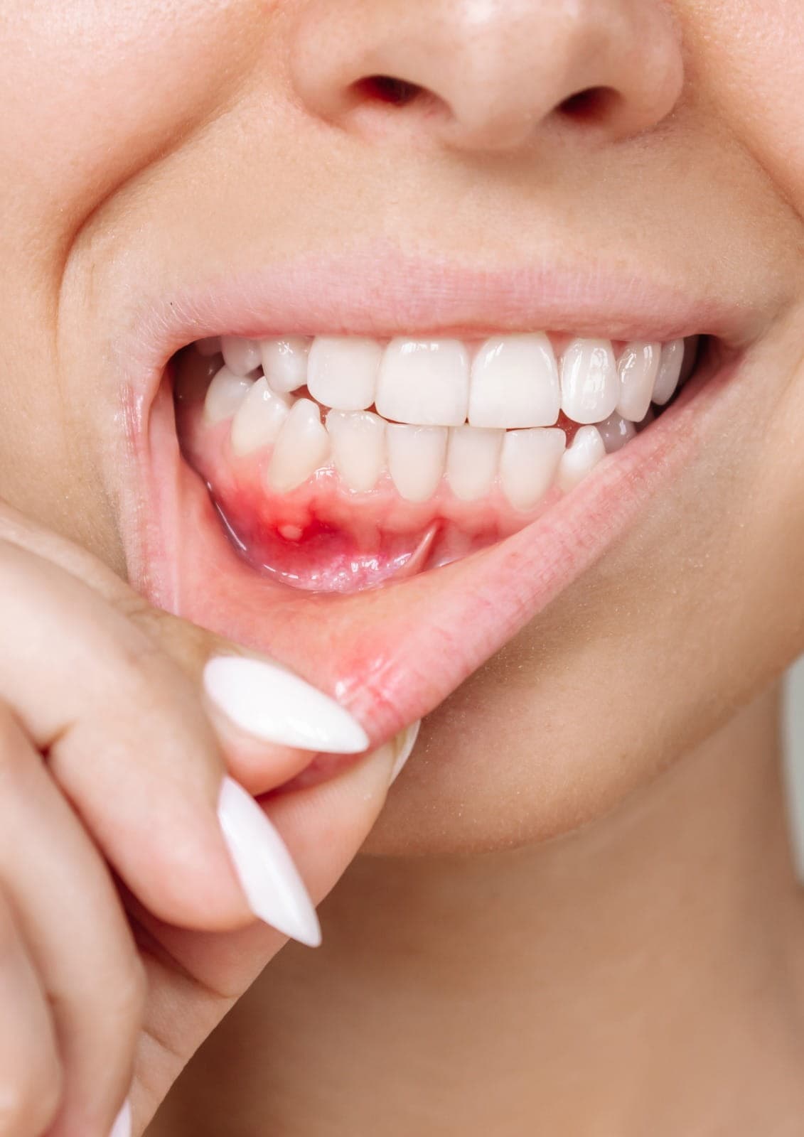 High-quality dental Treatment ensuring patient safety and effective results.