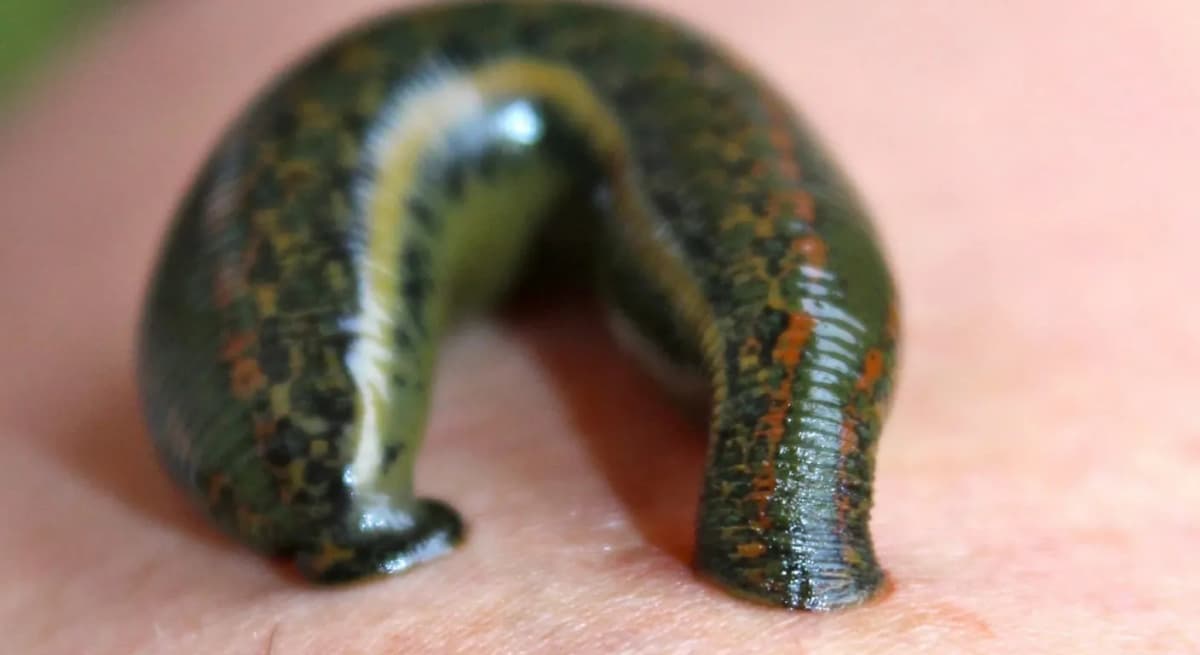 Educational illustration of a medicinal leech on a neutral background