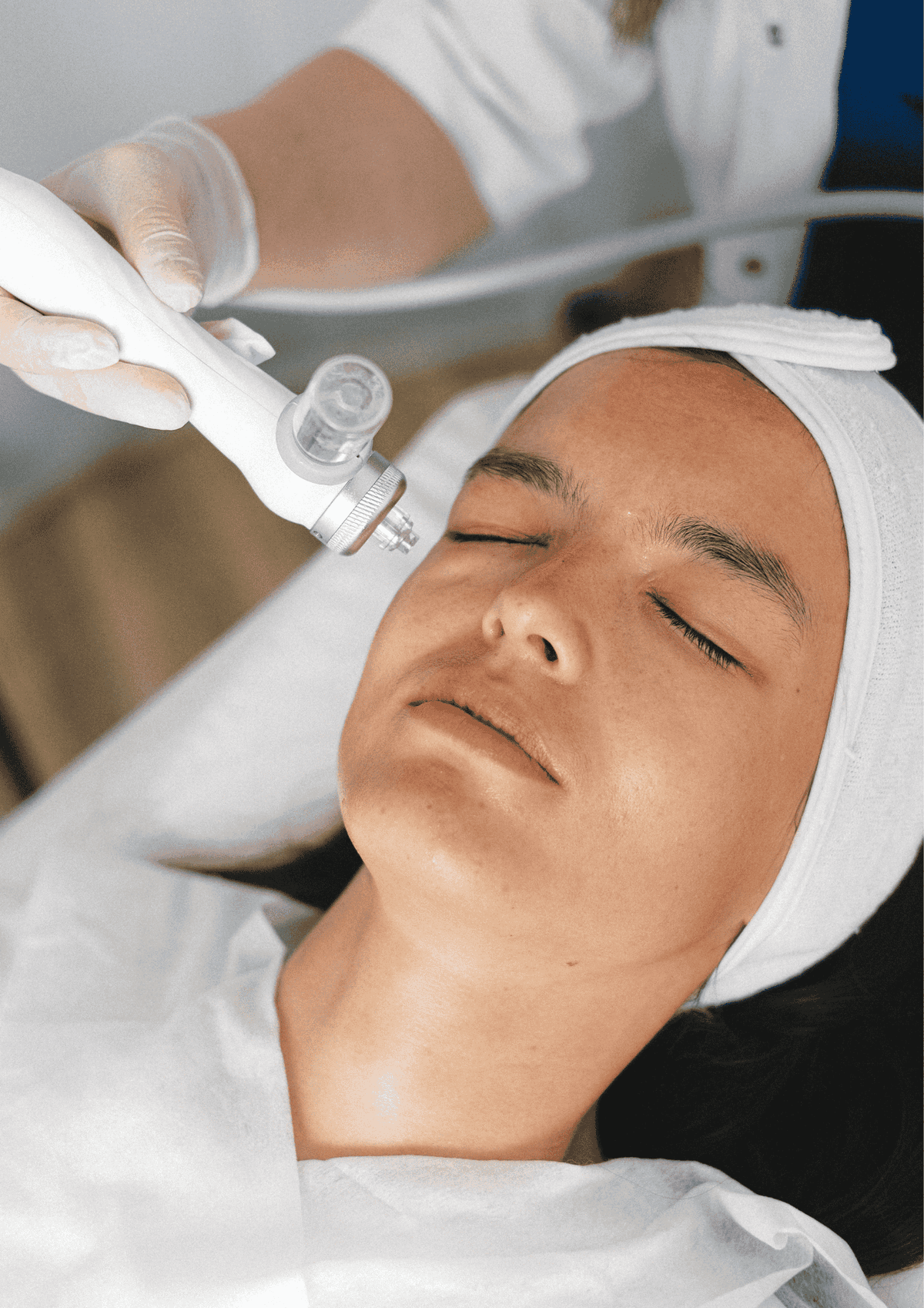 Laser Treatment - Precision Skin and Hair Solutions