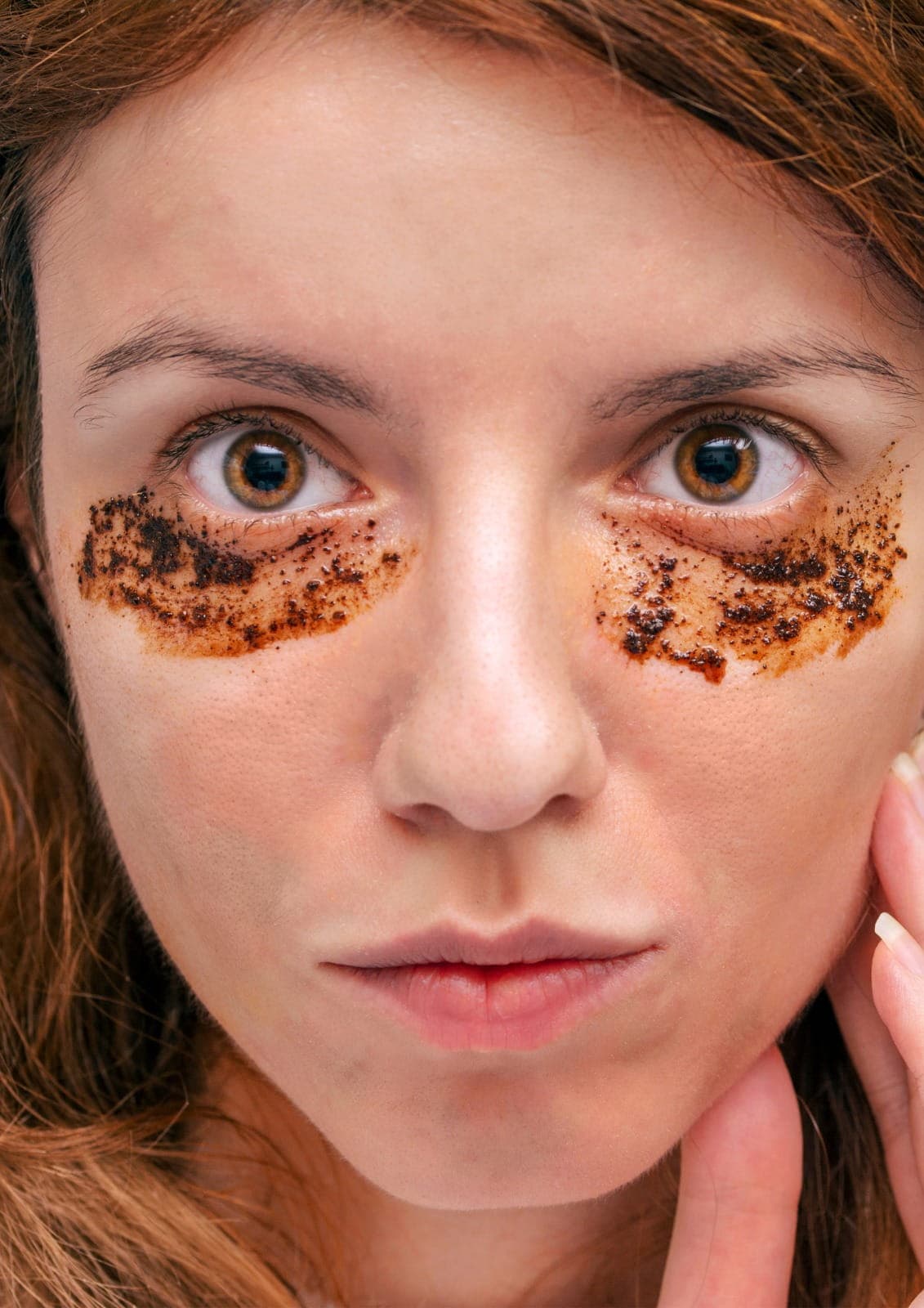 Dark circle treatment performed by specialists to reduce under-eye pigmentation and refresh the appearance.