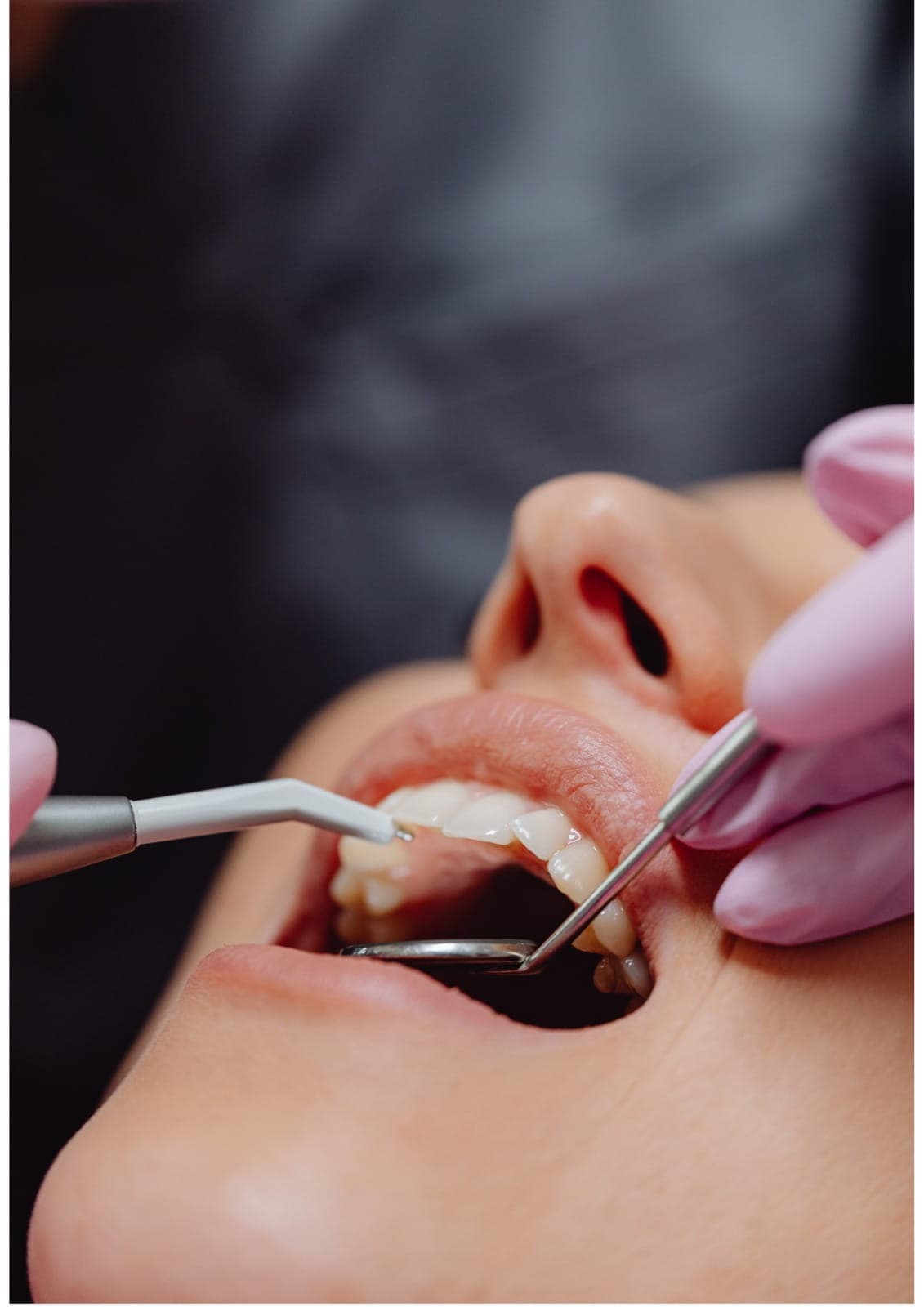 dental crown bridges in Dubai used to restore damaged or missing teeth and improve oral function.