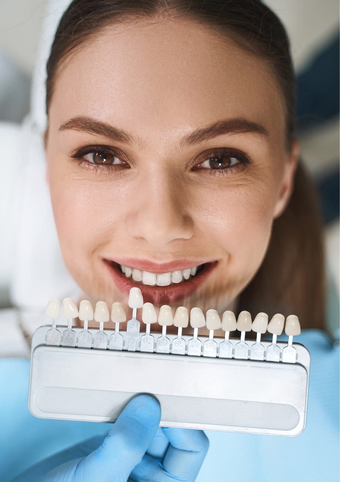 dental veneers applied by a skilled dentist to enhance smile appearance with natural-looking results.