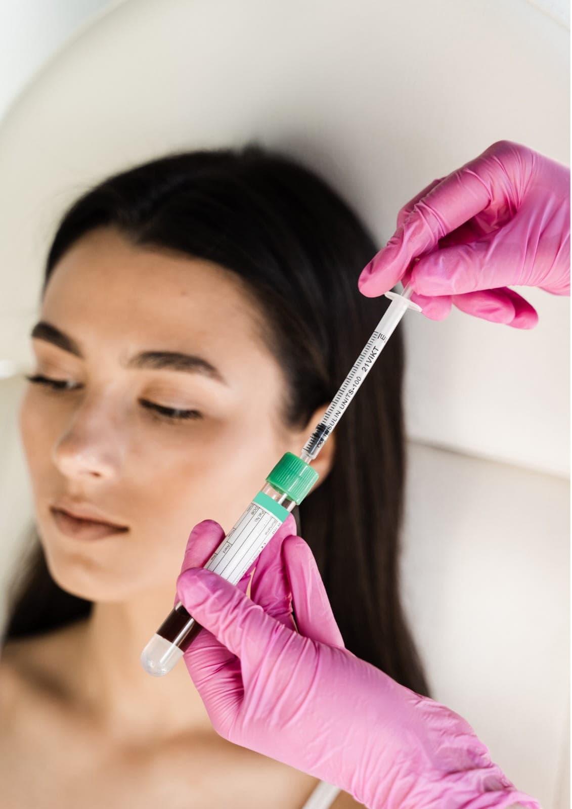 Face PRP in Dubai treatment performed by specialists to stimulate collagen production and improve skin texture and rejuvenation.