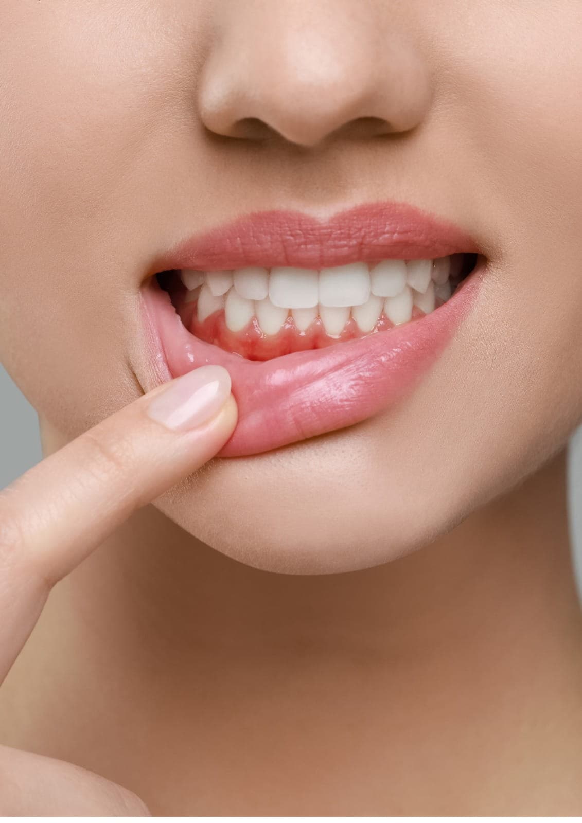 Gum disease treatment provided by dental specialists to improve gum health and prevent further infection