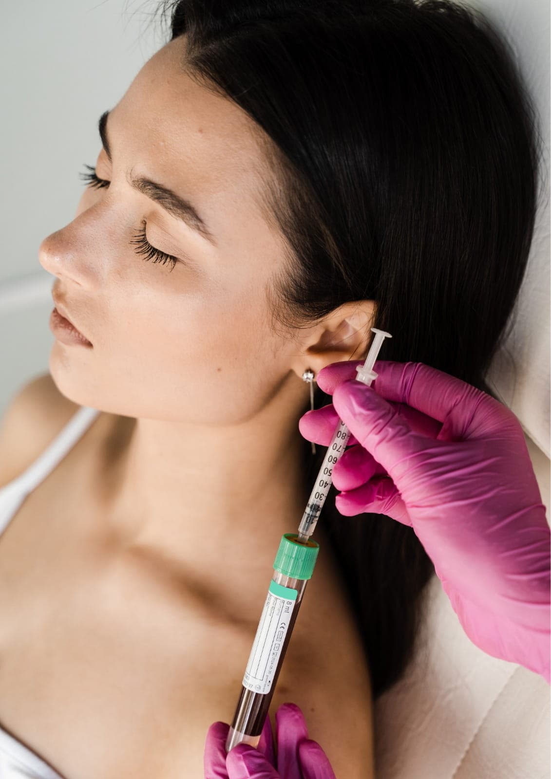 Hair PRP treatment in Dubai performed by specialists to stimulate hair growth and strengthen hair follicles.