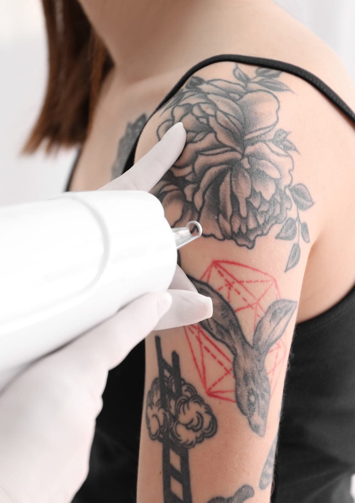 Tattoo removal in Dubai performed by specialists using advanced laser technology to safely fade unwanted tattoos.