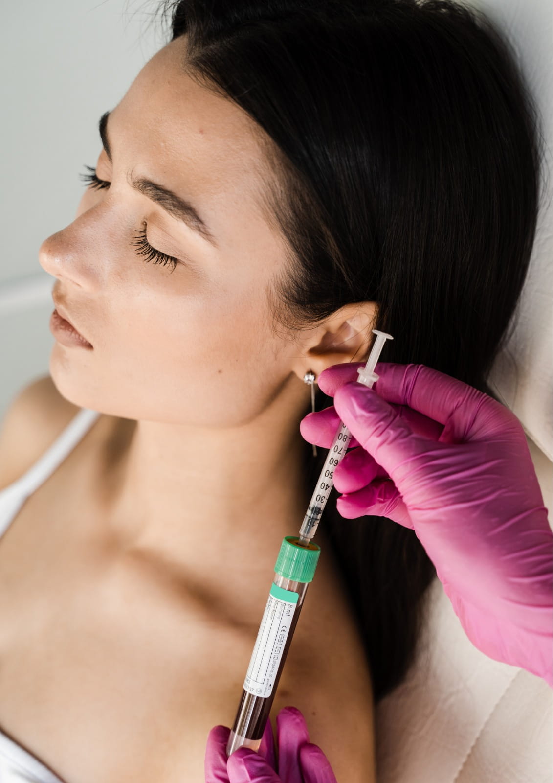 Hair PRP treatment in Dubai performed by specialists to stimulate hair growth and strengthen hair follicles.