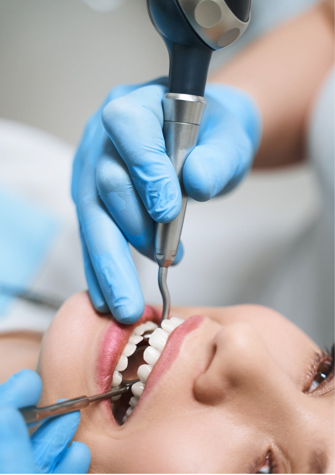 Root canal treatment performed by an experienced dentist to relieve tooth pain and restore dental health.
