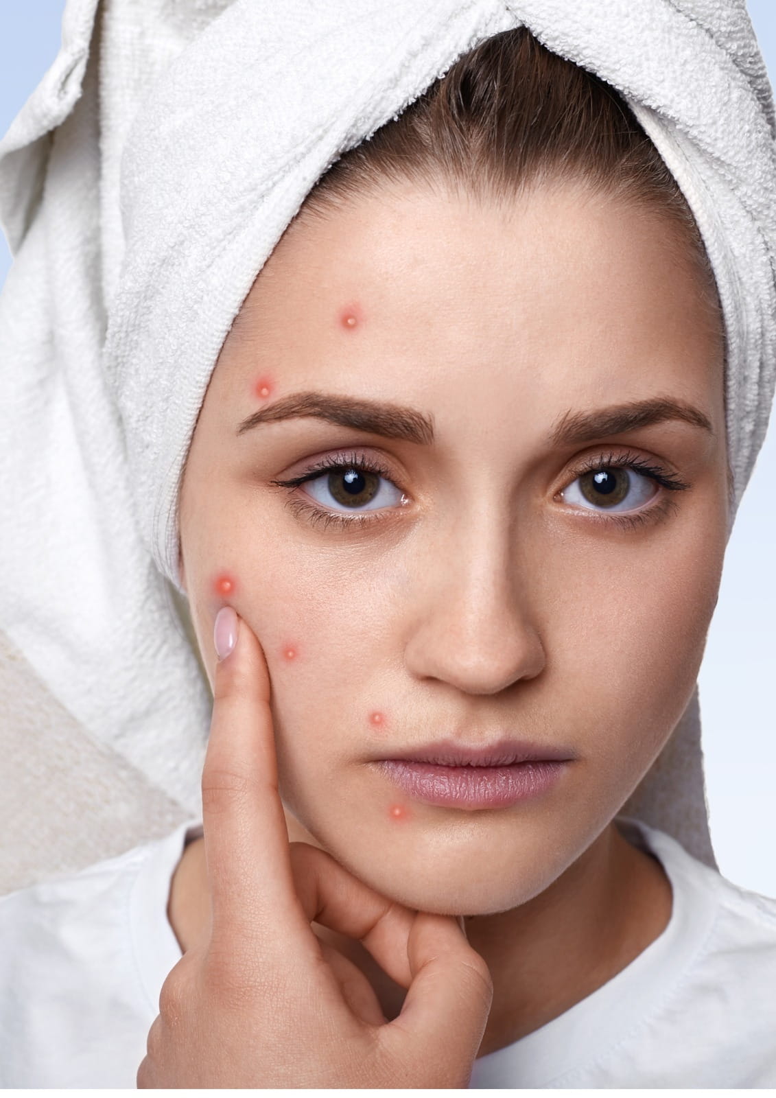 Skin allergy treatment in Dubai provided by specialists to relieve irritation and restore healthy skin.
